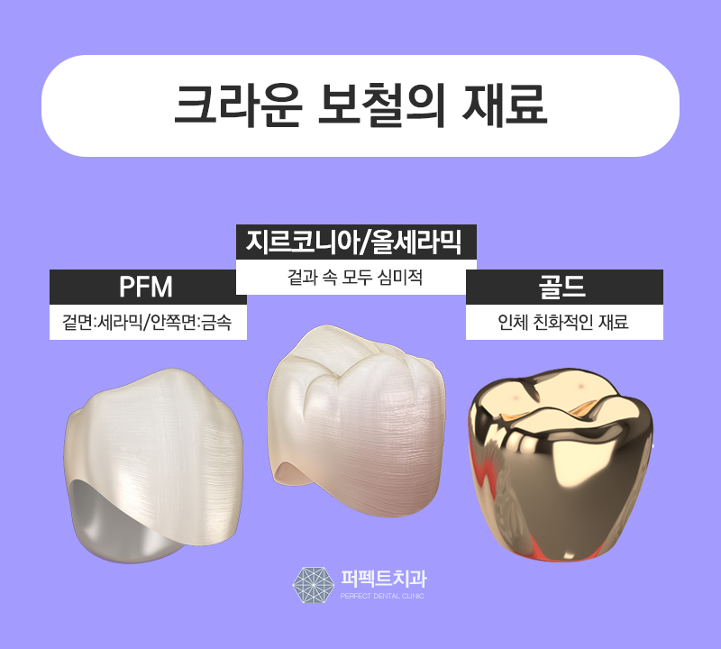 선릉역 어금니 지르코니아 가격 관련 이미지 3