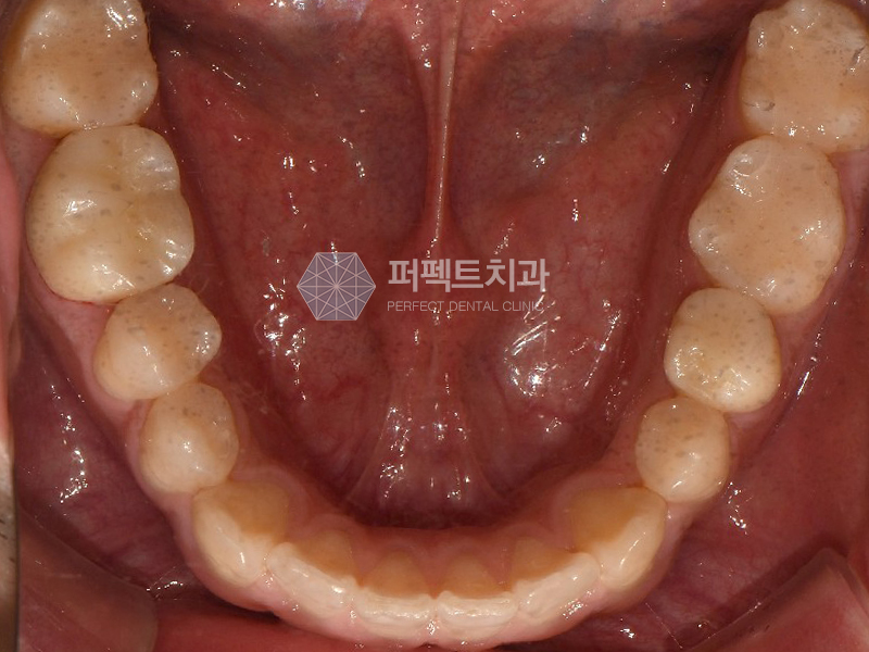 선릉역 치과 추천 확인해보세요! 관련 이미지 4