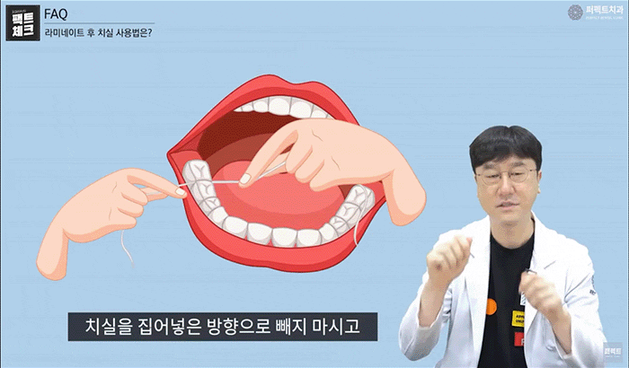 라미네이트 후 치실 사용 가능? 불가능? 관련 이미지 2