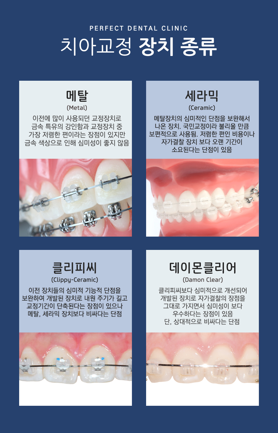 연예인 치아교정 궁금해? 관련 이미지 1
