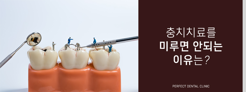충치치료 비용 얼마인가요? 관련 이미지 3