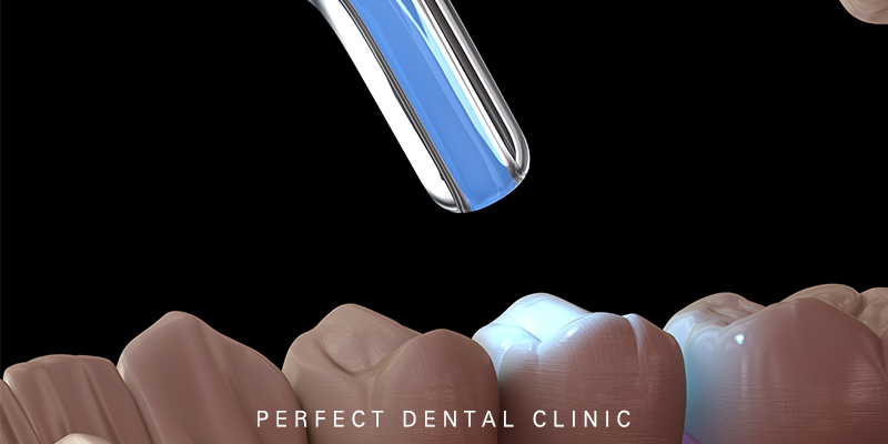 충치치료 단계와 치료방법 관련 이미지 1