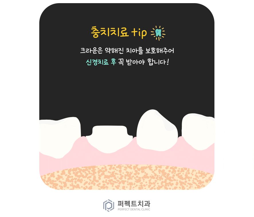 미룰수록 어려운 충치치료, 초기에 치료해요! 관련 이미지 9