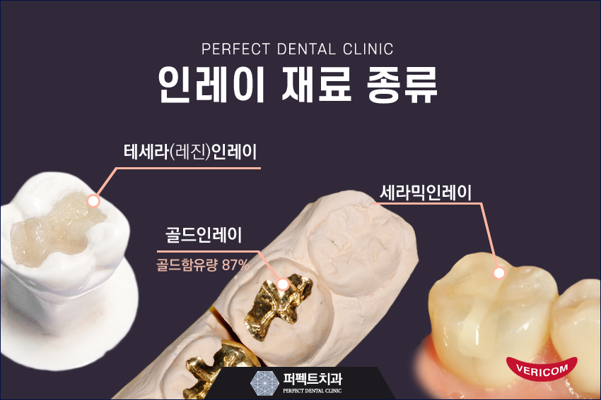 5월달 충치치료 저렴한 인레이 비용! 관련 이미지 2