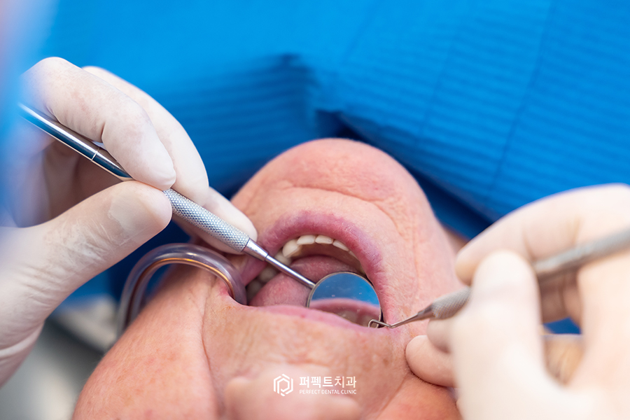 임플란트도 나이 제한이 있다?② - 노인편 관련 이미지 2