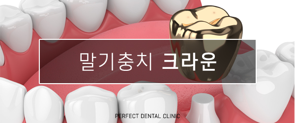 충치치료 비용 얼마인가요? 관련 이미지 6