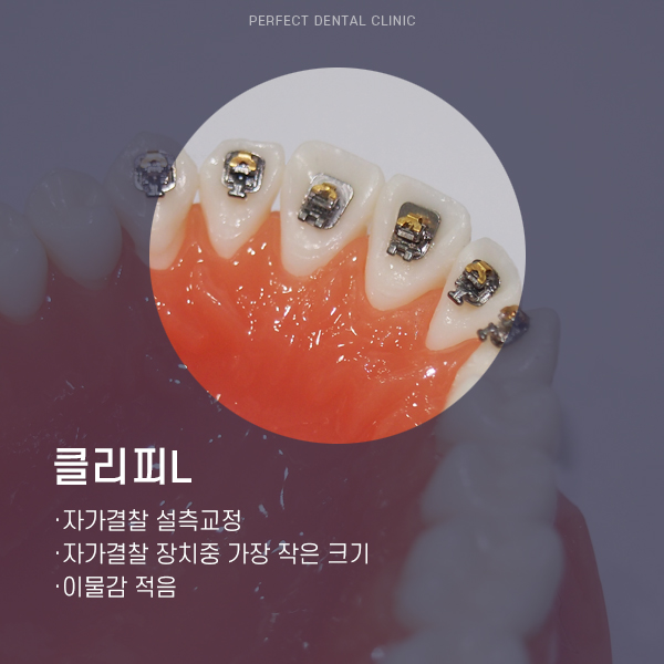 부분교정 찾는 사람들은 주목! 관련 이미지 4