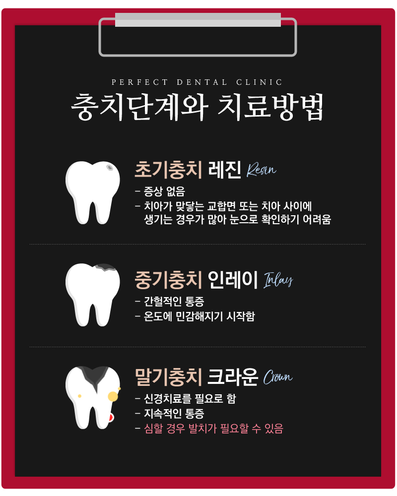 충치치료 받아야 한다면 "퍼펙트치과 충치DAY" 관련 이미지 4