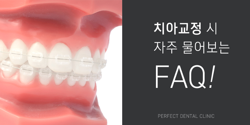 부분교정 믿고 맡길 수 있는 치과! 관련 이미지 5