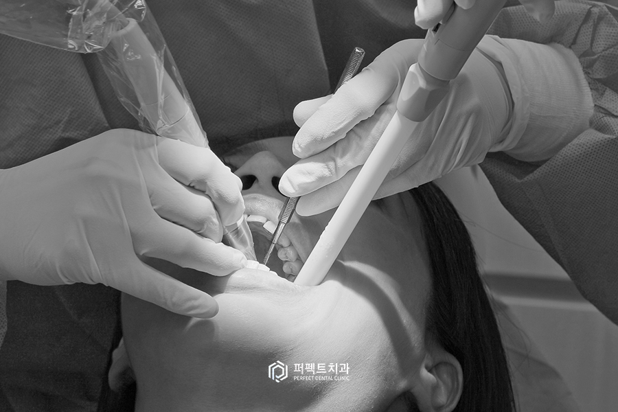 충치치료 후 치아가 시려요!(레진&인레이 치료 후) 관련 이미지 4