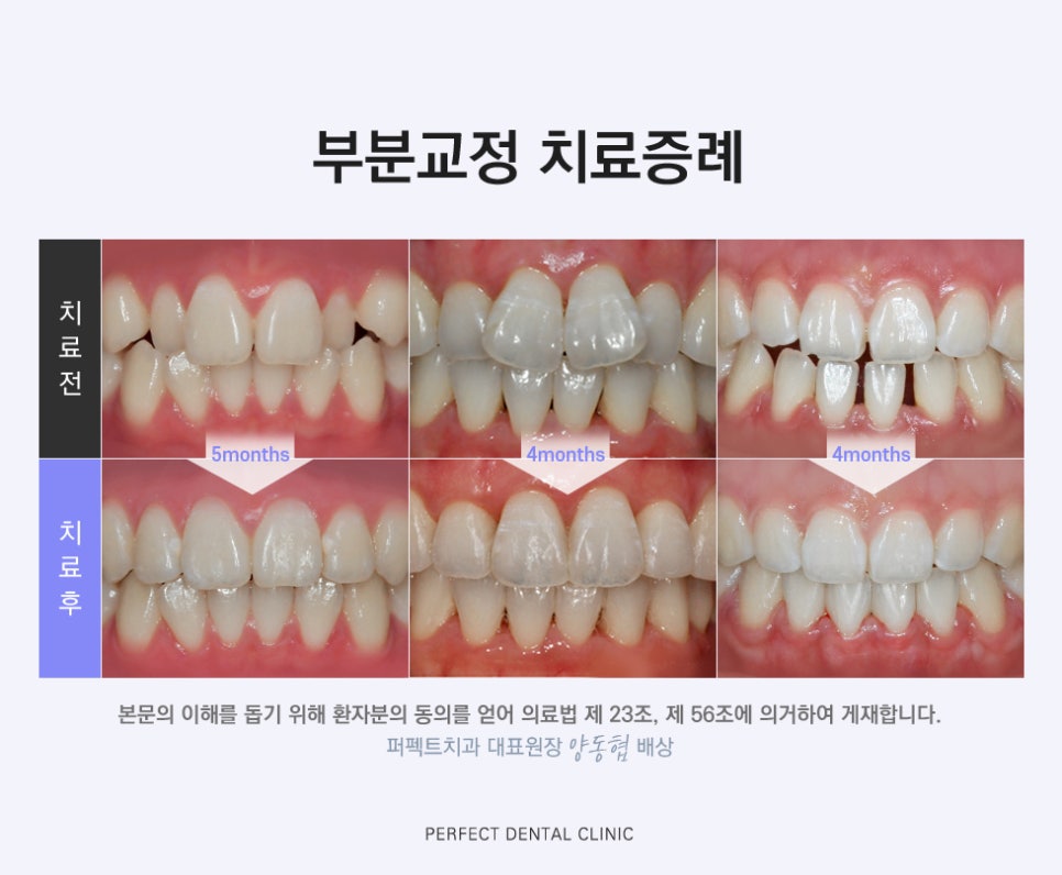 부분교정 믿고 맡길 수 있는 치과! 관련 이미지 4