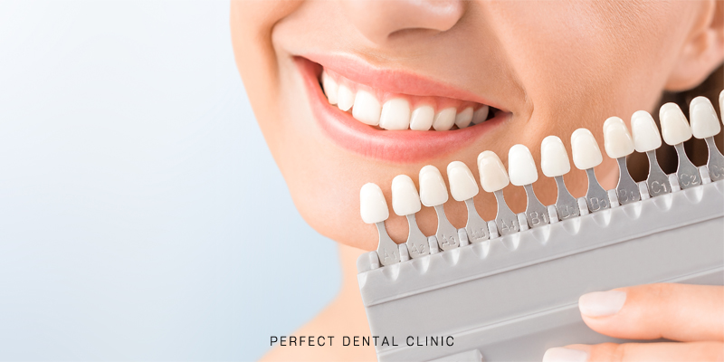 누런이 스트레스는 치아미백으로! 관련 이미지 1