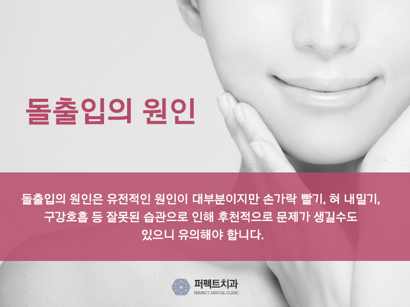 자가결찰장치 종류는? 관련 이미지 2