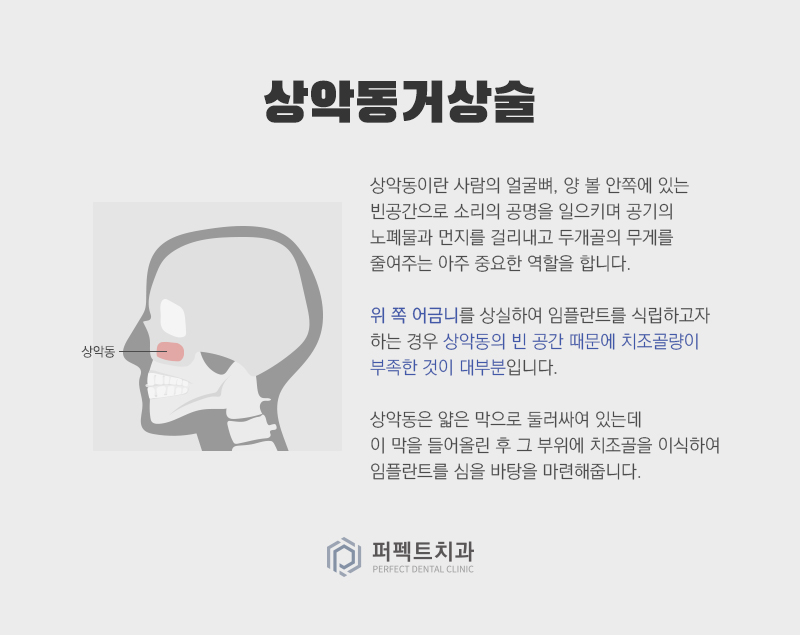컴퓨터 분석을 통한 임플란트 관련 이미지 10