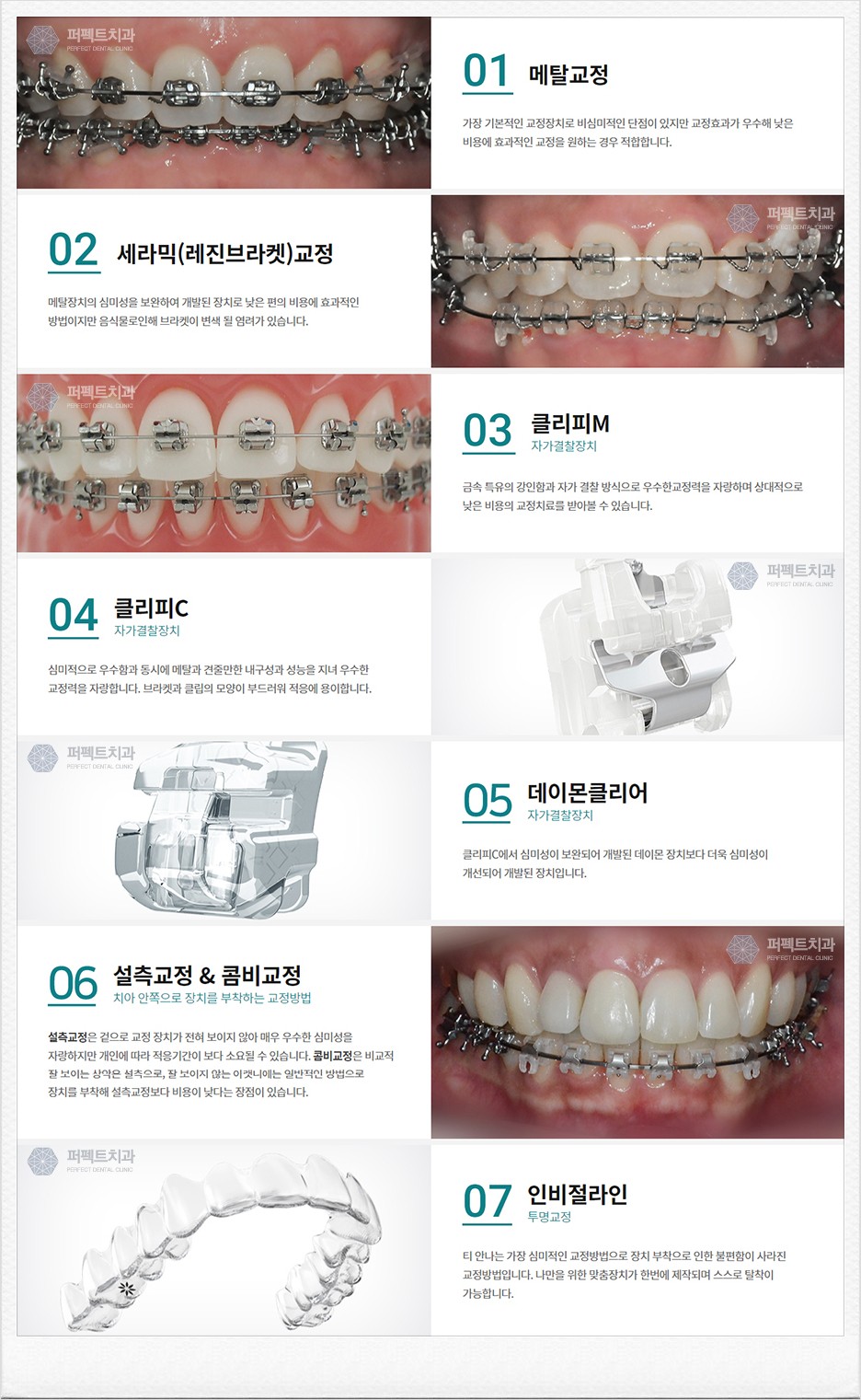 강남역치과 클리피씨교정 합리적인 비용! 관련 이미지 3