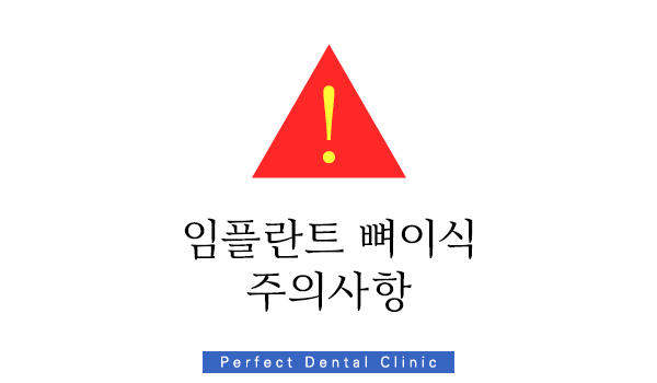 강남 임플란트 뼈이식 잘하는 곳 관련 이미지 2