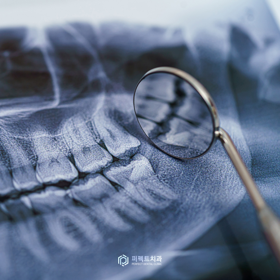 교정치료 중단 시 생기는 문제점은?(feat.교정치과 선택하는 tip!) 관련 이미지 3