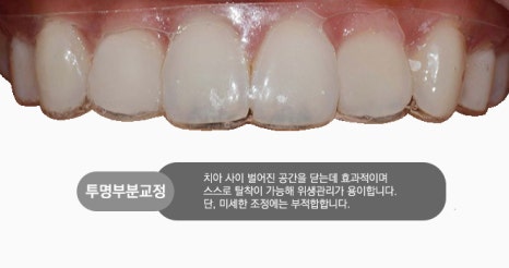 고민되는 부분만 집중적으로 부분교정 하자! 관련 이미지 5
