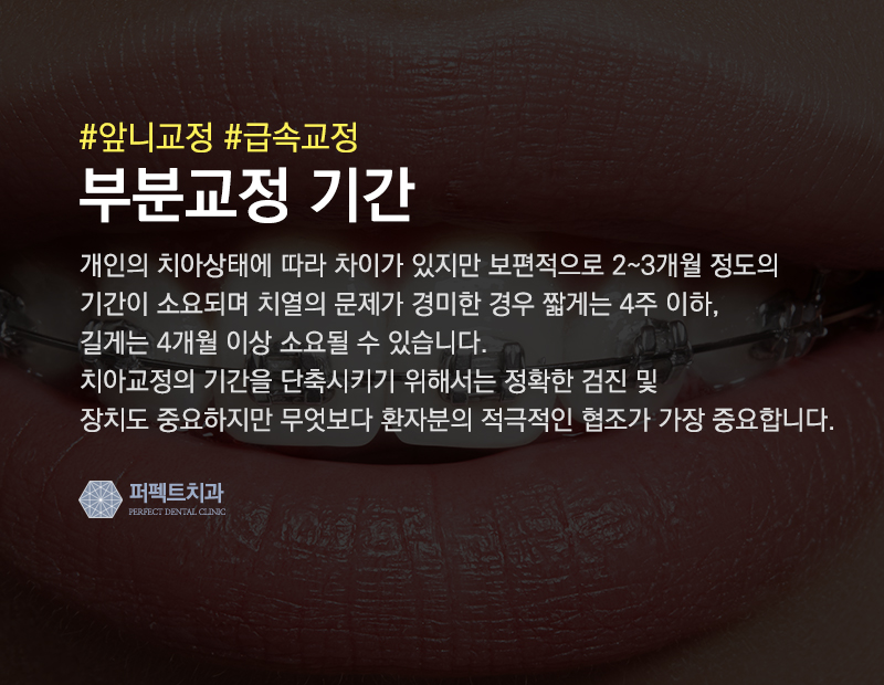 성인 앞니부분교정 관련 이미지 2