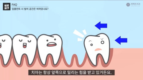 어금니 임플란트 부작용, 미리예방! 관련 이미지 3