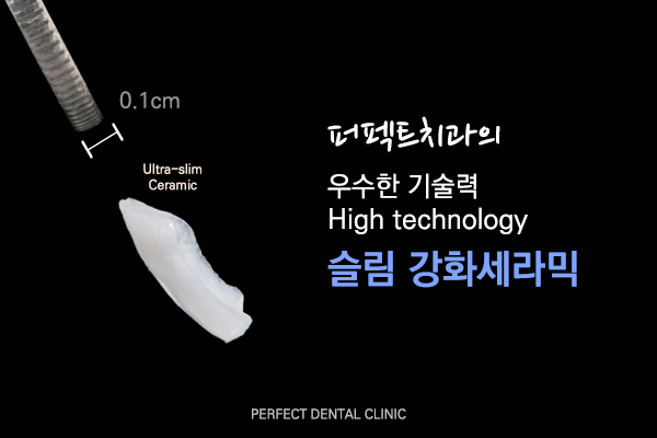 0.1mm 미니컷 라미네이트 들어봤니? 관련 이미지 2