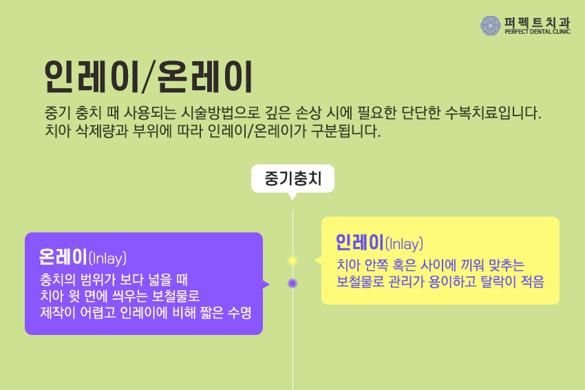 5월달 충치치료 저렴한 인레이 비용! 관련 이미지 4