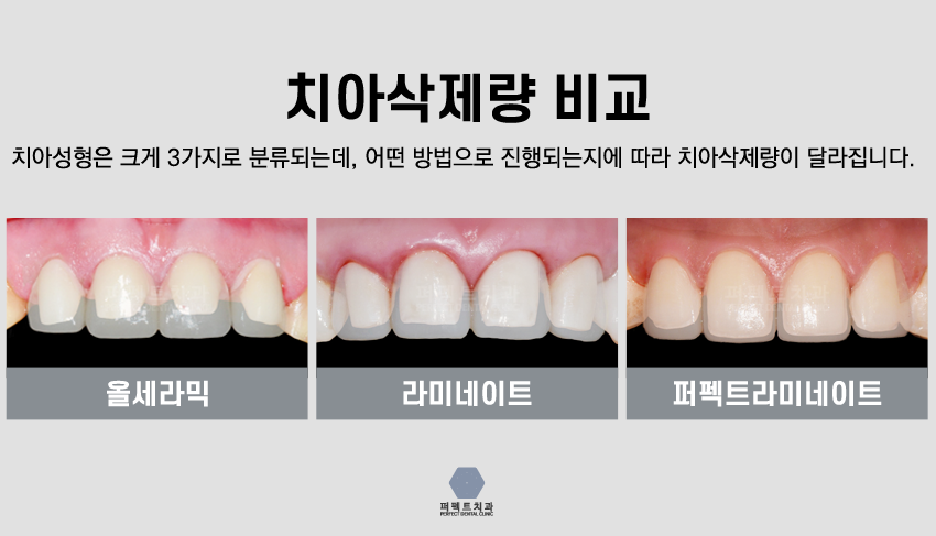 퍼펙트라미네이트!! 관련 이미지 6