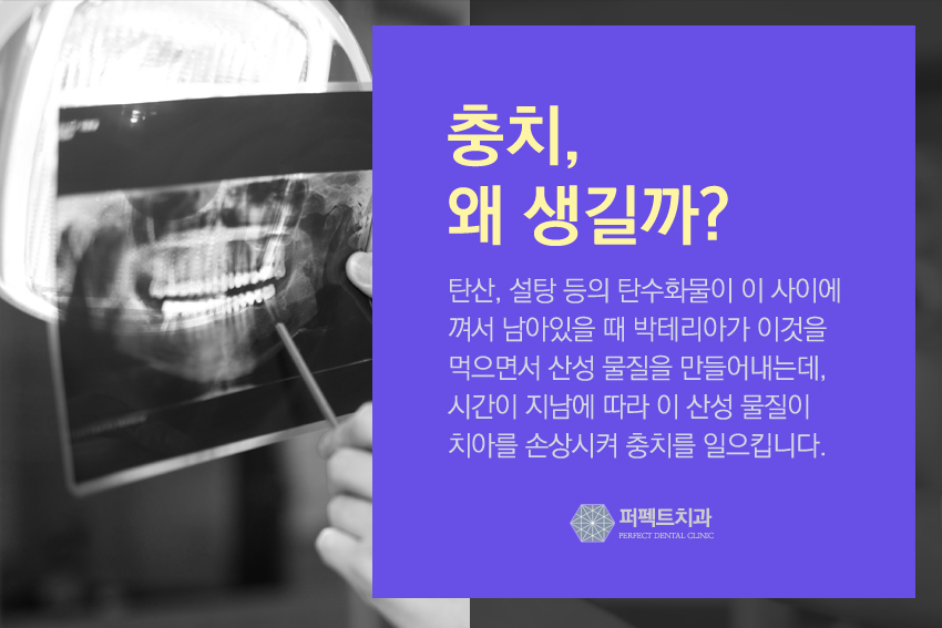 부담없는 충치치료가격 충치DAY로~&hearts; 관련 이미지 3