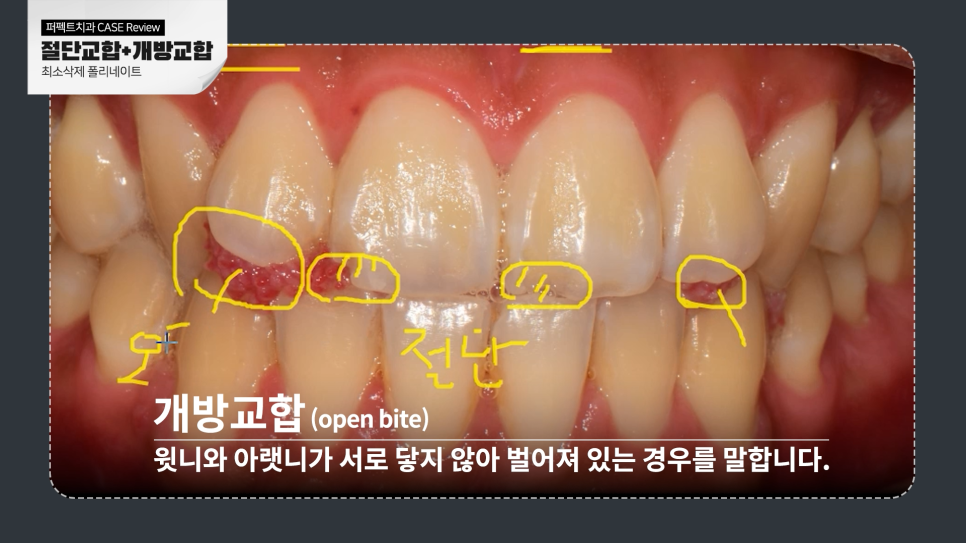 남자라미네이트, 더 오래 사용하려면? 관련 이미지 2