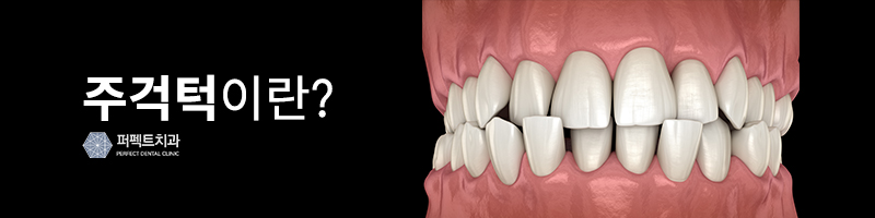성인주걱턱교정 수술없이 해결! 관련 이미지 2