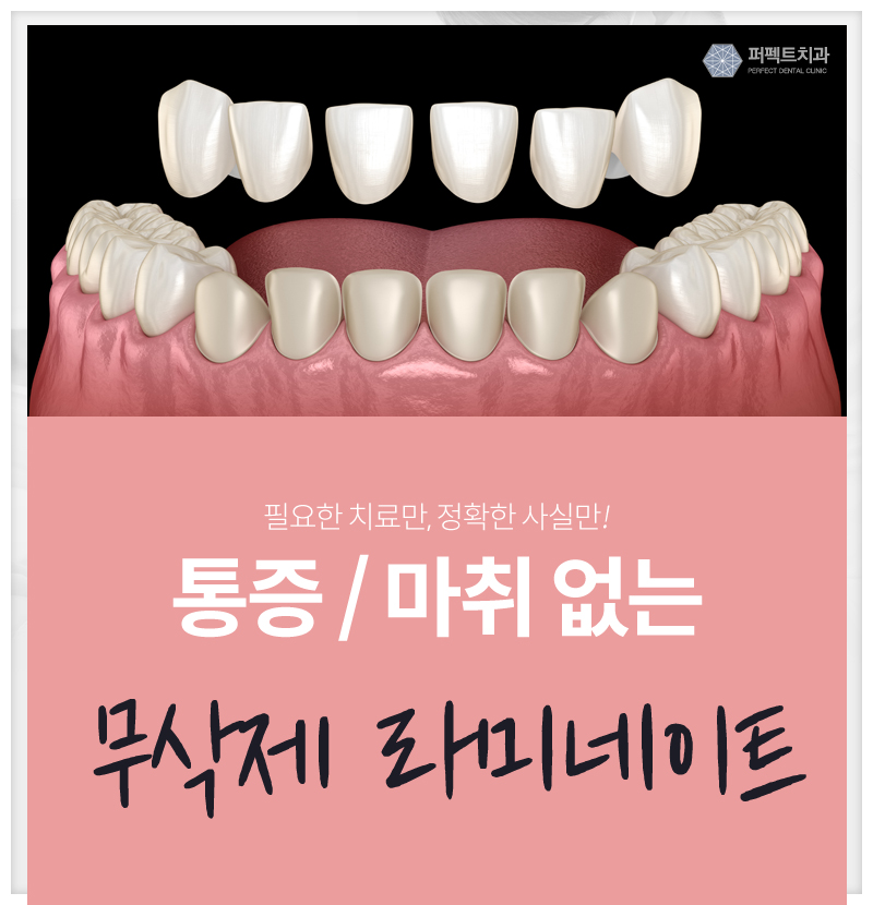 무통증 / 무마취, 무삭제라미네이트 알아보기 관련 이미지 1