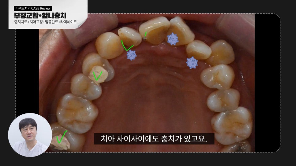 복합적인 치료가 필요한 케이스 리뷰 관련 이미지 3