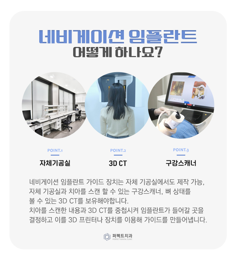 네비게이션 임플란트? 일반 임플란트랑 뭐가 달라?! 관련 이미지 2