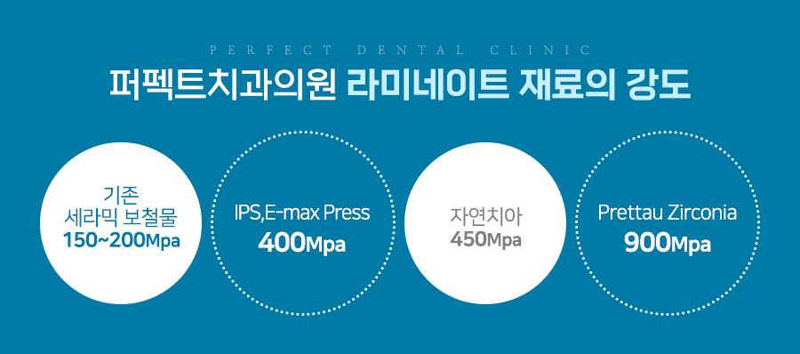 라미네이트 치료 시 참고사항은? 관련 이미지 7