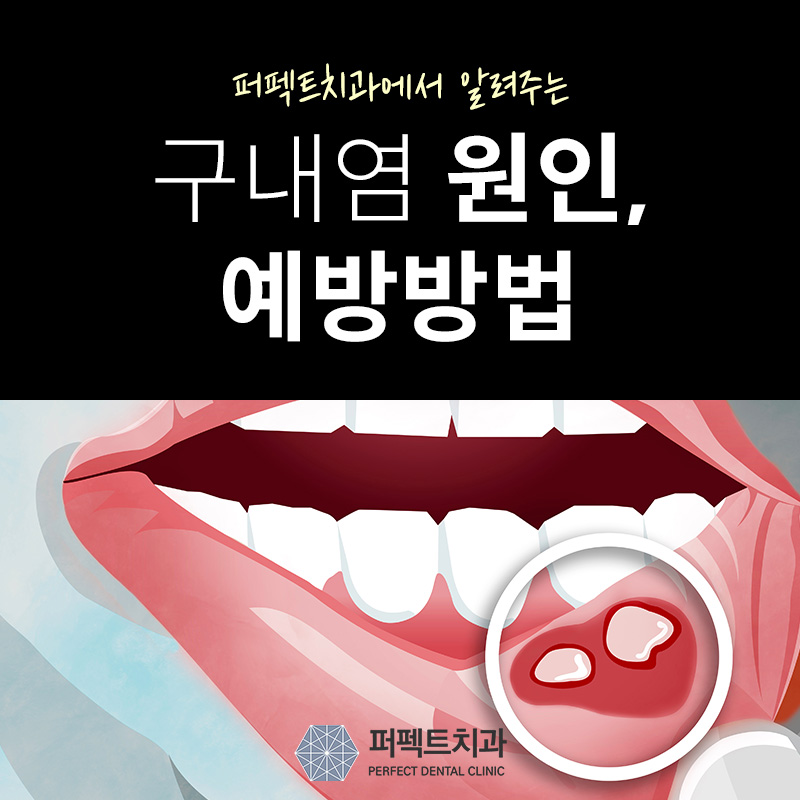 유아 구내염 원인, 치료법 관련 이미지 1