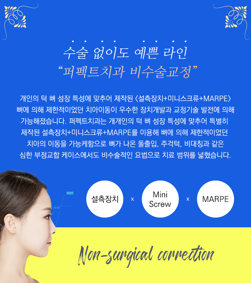 자가결찰 클리피씨전체교정 비용은 어떻게? 관련 이미지 7