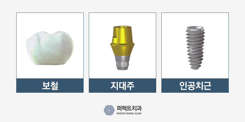 노인 임플란트 건강보험 혜택은? 관련 이미지 5