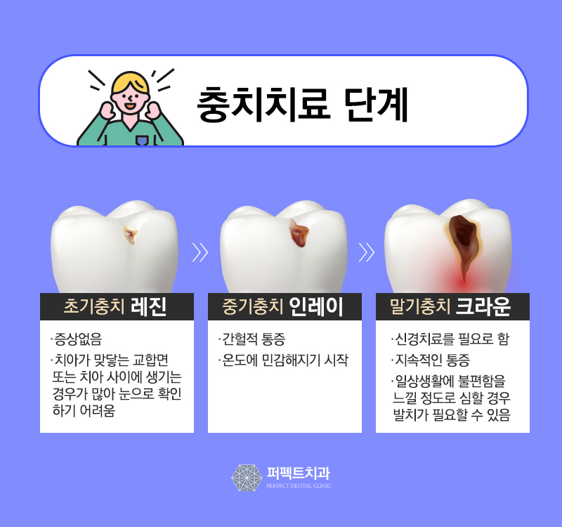 선릉역 어금니 지르코니아 가격 관련 이미지 2