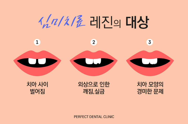 앞니 심미치료, 레진으로도 하고 있어! 관련 이미지 4