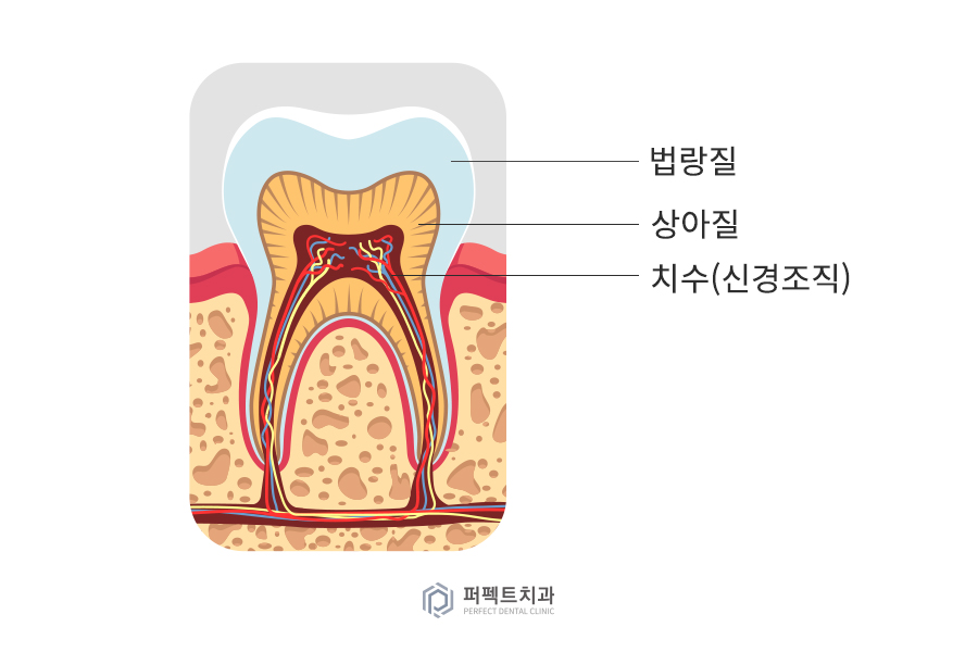 신경치료란 무엇일까요? 관련 이미지 2