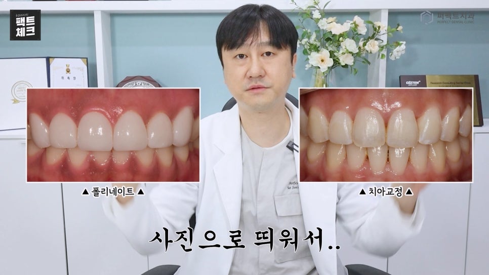 나비치아, 부분교정vs라미네이트 치과의사가 추천하는 방법은? 관련 이미지 10