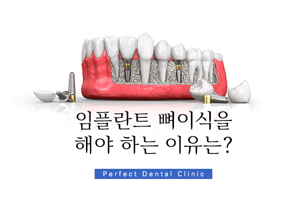강남 임플란트 뼈이식 잘하는 곳 관련 이미지 1