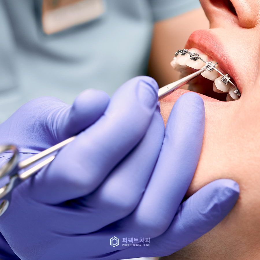 교정치료 중단 시 생기는 문제점은?(feat.교정치과 선택하는 tip!) 관련 이미지 2