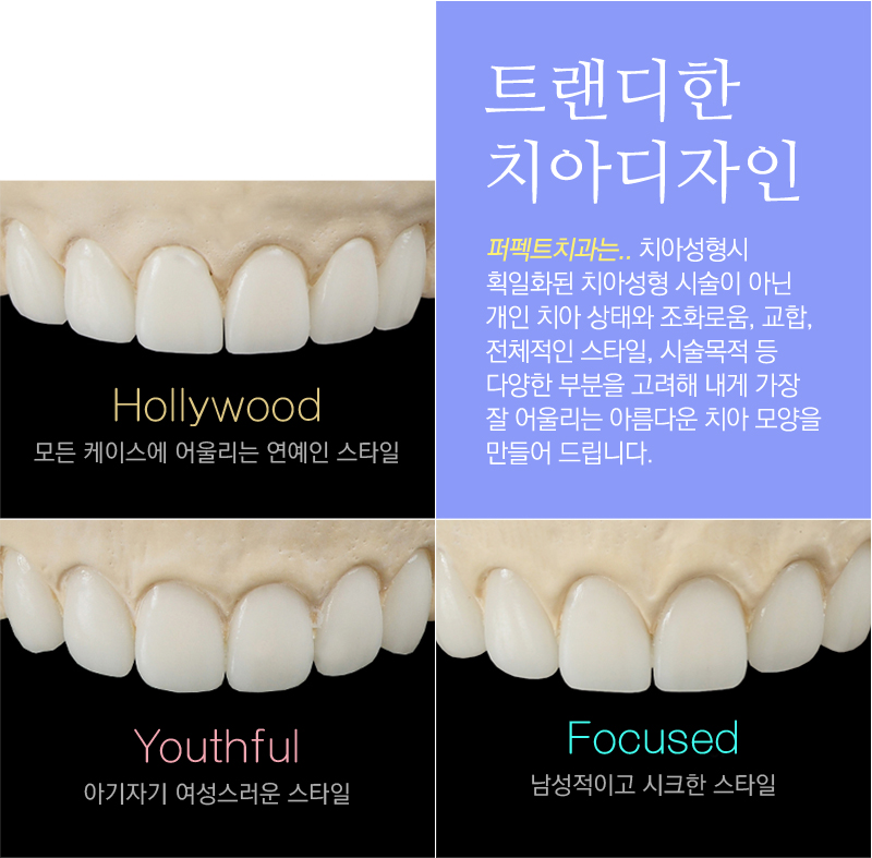 라미네이트 감쪽같은 치아성형 관련 이미지 1