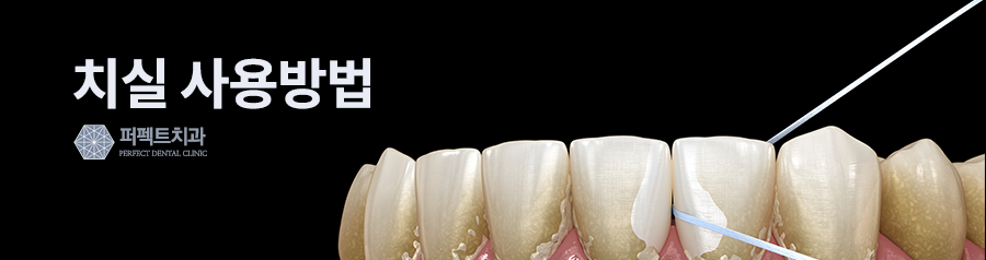 치실의 종류와 치실사용방법이 궁금하다면? 관련 이미지 4