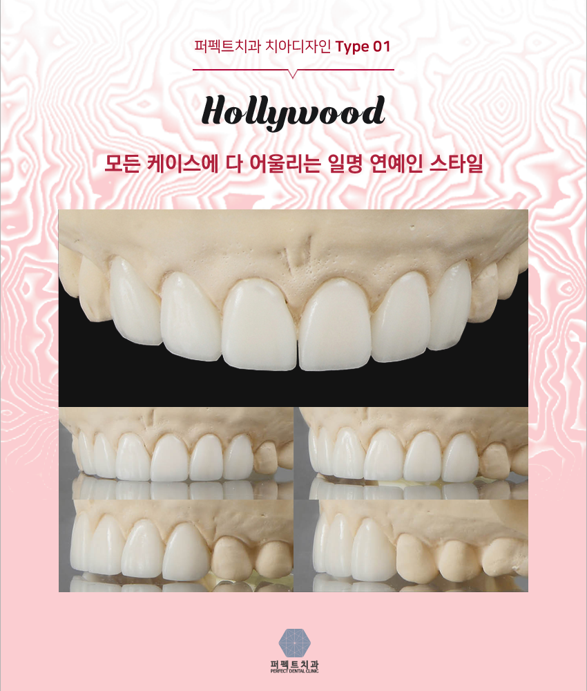 올세라믹크라운 저렴한곳! 관련 이미지 4