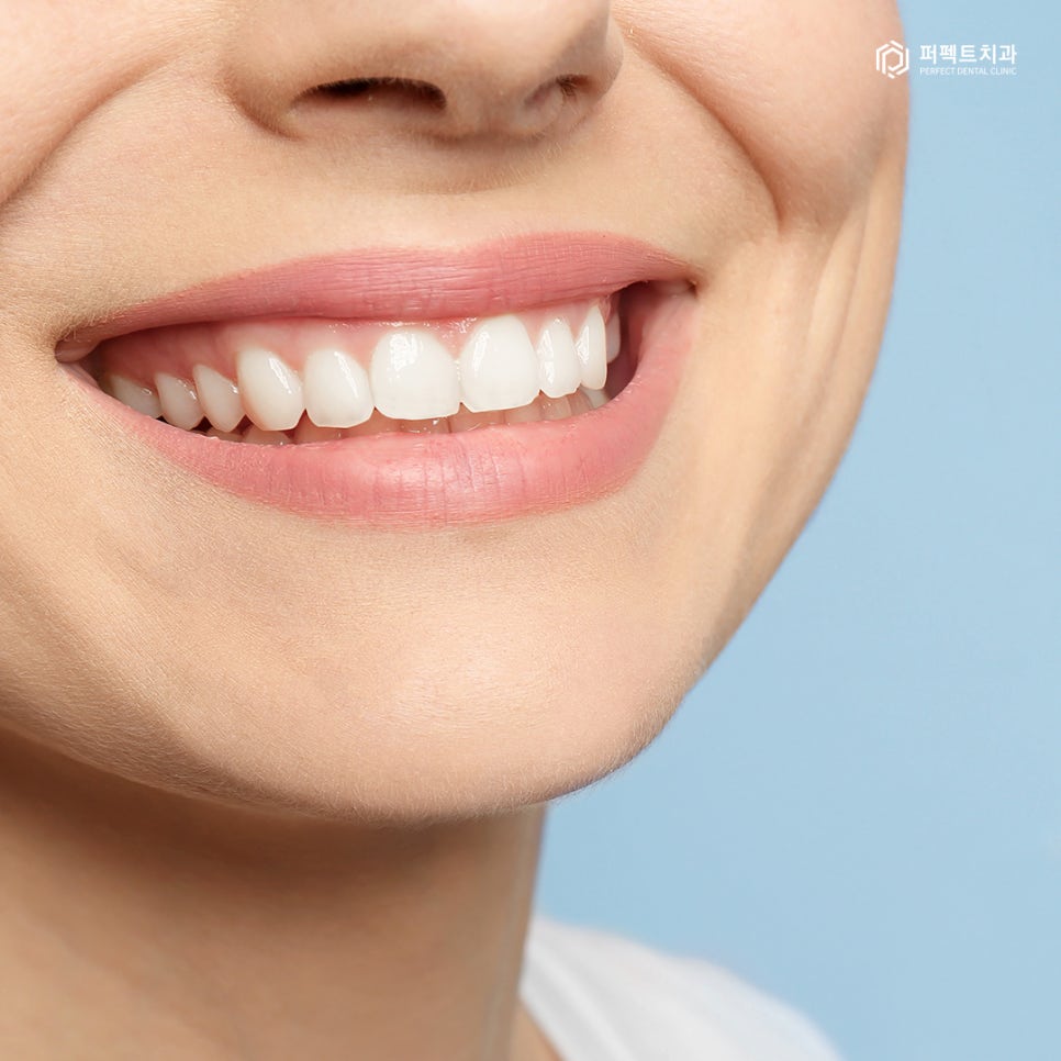 무삭제 라미네이트 추천 및 가능한 케이스 확인하기 관련 이미지 8