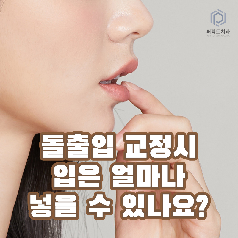 돌출입 교정 시 입을 얼마나 넣을 수 있을까? 관련 이미지 1