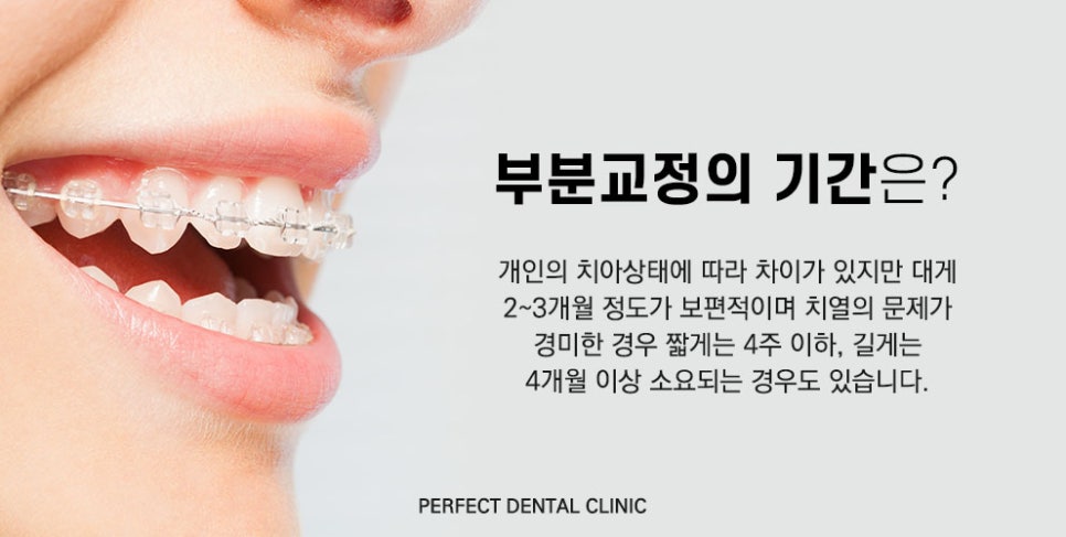 아랫니 부분교정 비용은? 관련 이미지 1