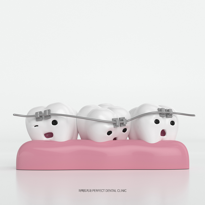 치아재교정시 알아두어야 하는 것, 골격비대칭 치아교정으로도 가능? 관련 이미지 4